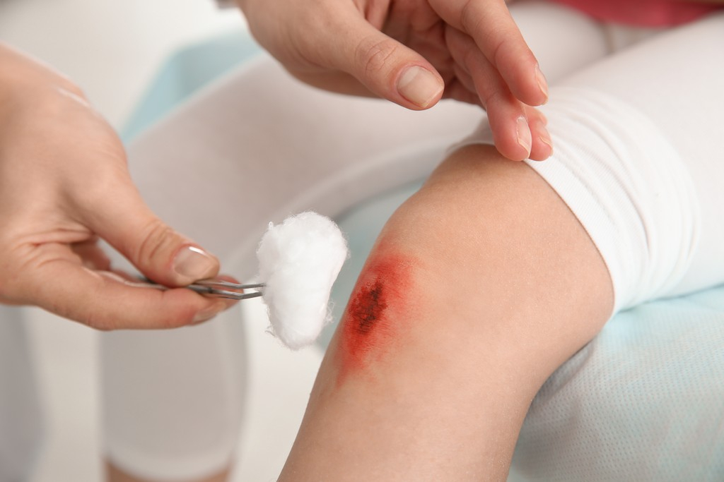 proper-wound-care-that-can-avoid-infection